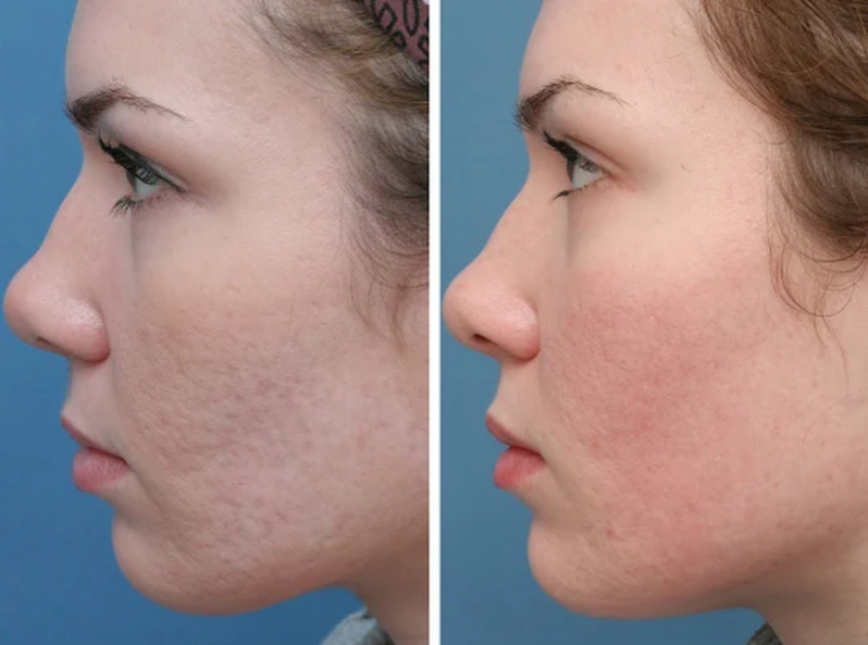 Clínica de Estética Avançada Aberta Agora Consolação - Clínica Estética Facial