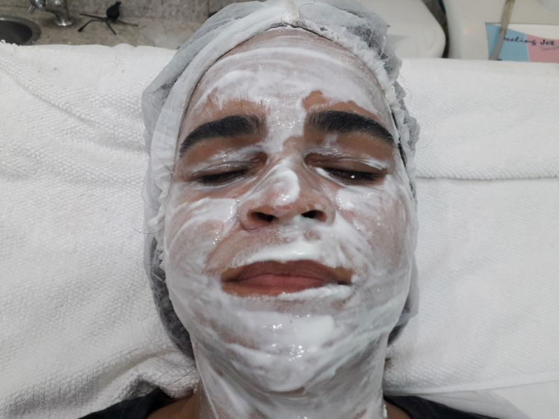 Limpeza de Pele para Noiva Bela Cintra - Limpeza de Pele Acne