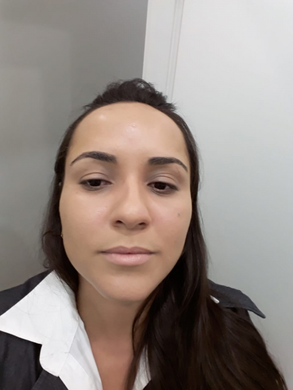 Limpeza de Pele para Tirar Cravos Preço Bela Cintra - Limpeza de Pele Acne