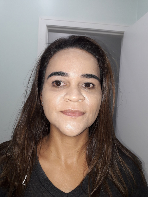 Quanto Custa Limpeza de Pele para Noiva Vila Mariana - Limpeza de Pele Dermatologista