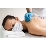 acupuntura para dor lombar Higienópolis