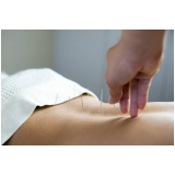 clínica de acupuntura para emagrecer contato Bela Cintra