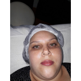 clínica de estética tratamento para olheiras Ana Rosa