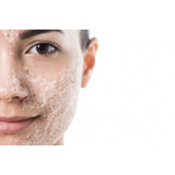 clínica de tratamento pele rosto Consolação