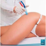 peeling de cristal barato Bela Cintra