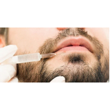 preenchimento labial masculino Consolação