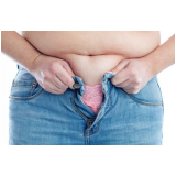 Tratamento de Gordura Localizada Estética