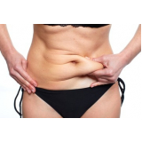 tratamento de gorduras localizadas na barriga Bela Vista