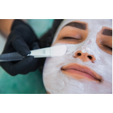 tratamentos de pele a laser Ana Rosa