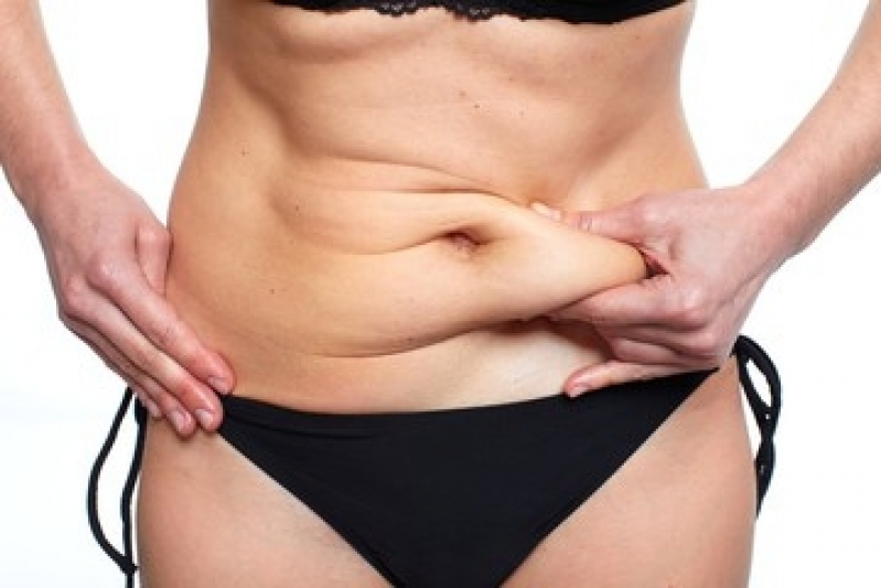 Tratamento de Gorduras Localizadas na Barriga Bela Vista - Clínica de Tratamento de Gordura Localizada